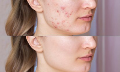 الخدمات - Medgel